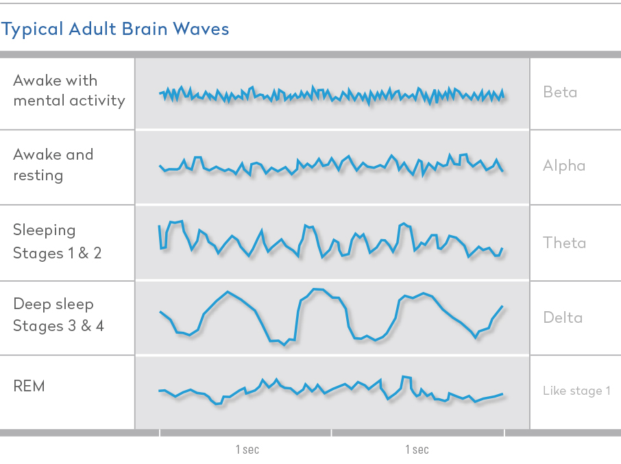 Diagram-of-typical-adult-brain-waves-throughout-sleep-cycles
